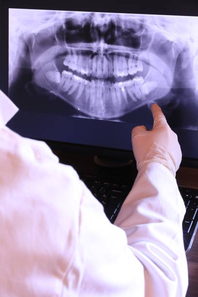 Best Knocked-Out Tooth (Avulsed Tooth) Treatment in Colonial Beach, VA